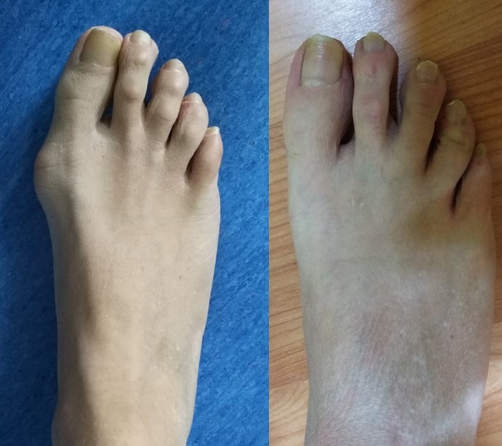 Prima e dopo l'intervento